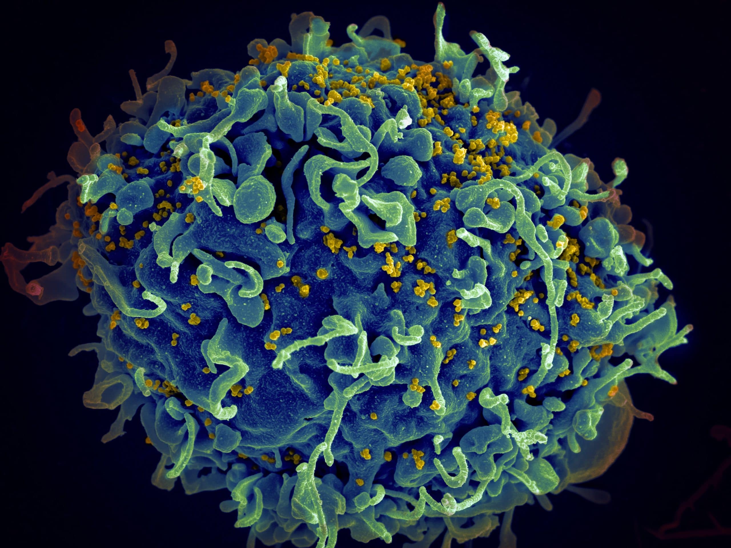 new updates on hiv cure research